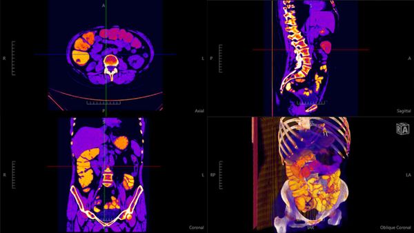 Navegatium: A Free 2D/3D DICOM Viewer with 3D Printing support for Windows