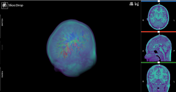 The X Toolkit: Open source Browser-based 3D Scientific & Medical Visualization Framework for building Web-based WebGL powered apps