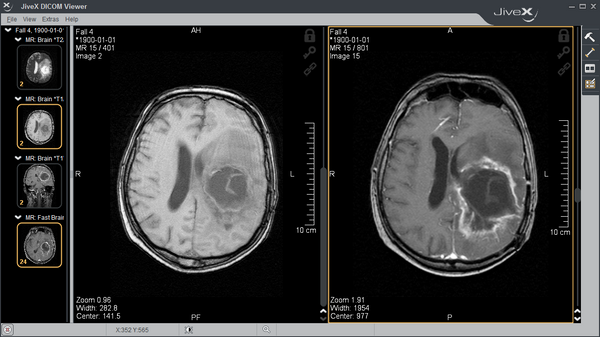 JiveX - Free DICOM Viewer for Windows