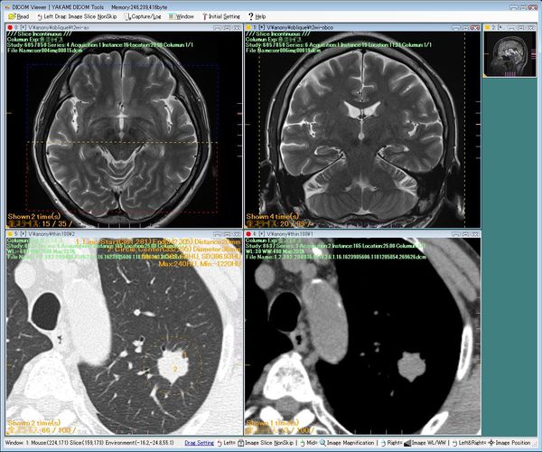 Yakami DICOM tools: free lightweight DICOM  viewer, & converter for Windows