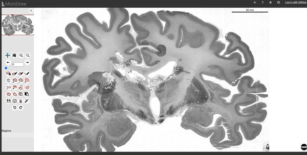 Collaboratively Annotate large-scale DeepZoom images with MicroDraw