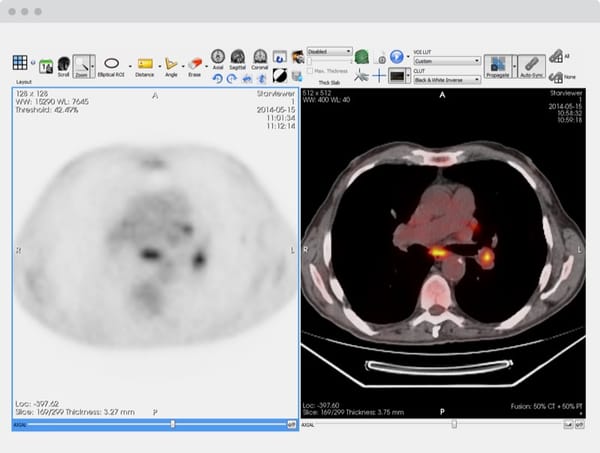 Starviewer is an Open-source Free Medical Imaging Software for Researchers and Radiologists