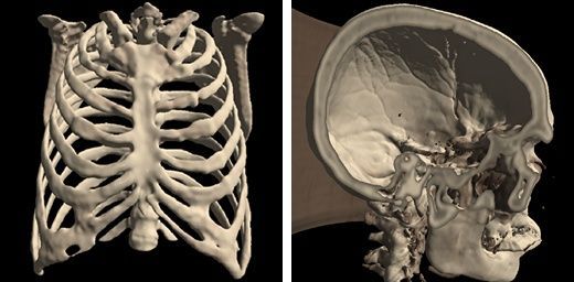 Med3Web: Free, Open source Browser-based DICOM viewer for 2D/ 3D Medical Visualization