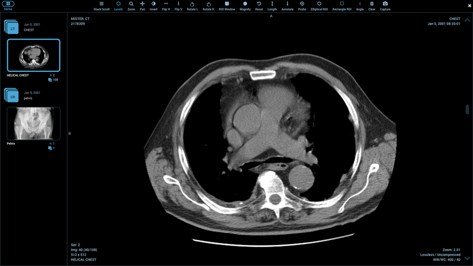 15 Best Open-source Web-based DICOM Viewers