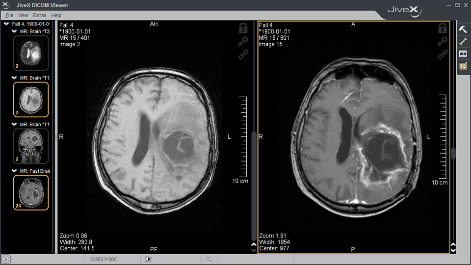 JiveX - Free DICOM Viewer for Windows