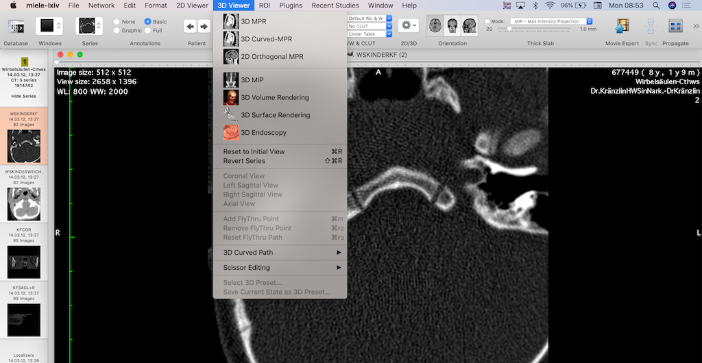 10 Best Free Open source PACS Clients and DICOM Workstations for Windows, Mac OSX and Linux