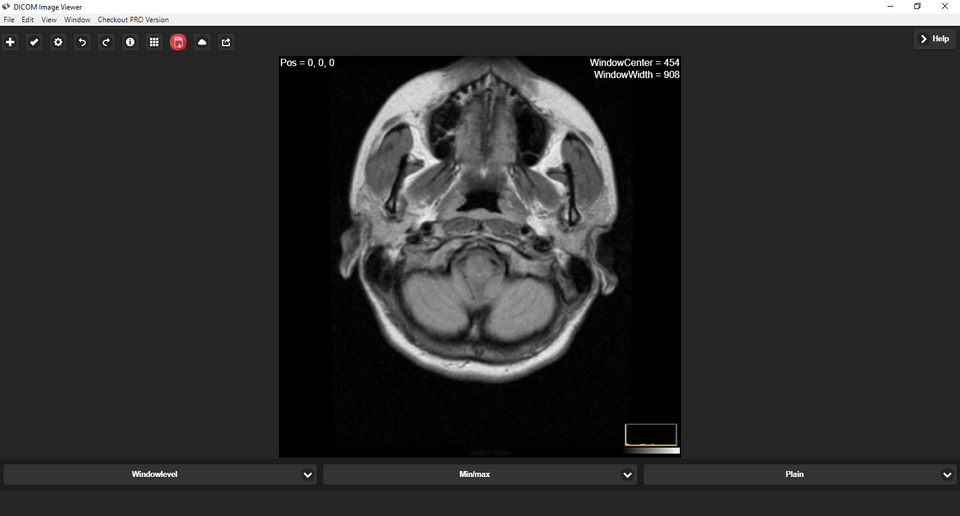 DICOM Image Reader: A Lightweight DICOM Viewer for DCM files