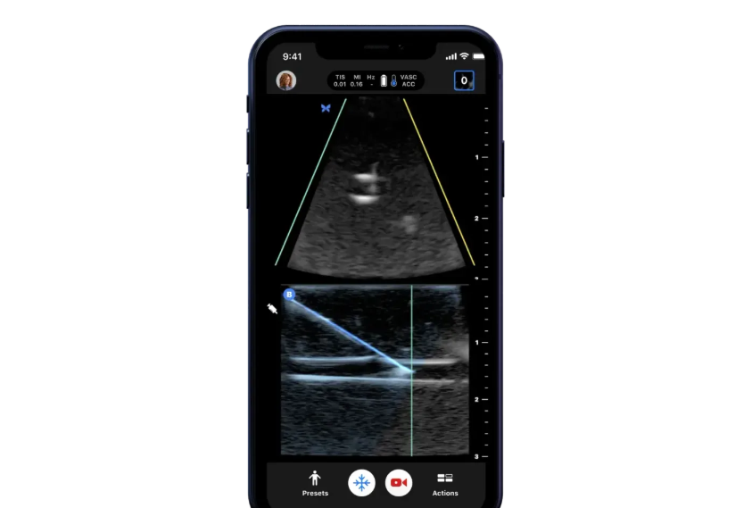 Top 8 Portable Ultrasound Machines, Which One to Choose for Your Business